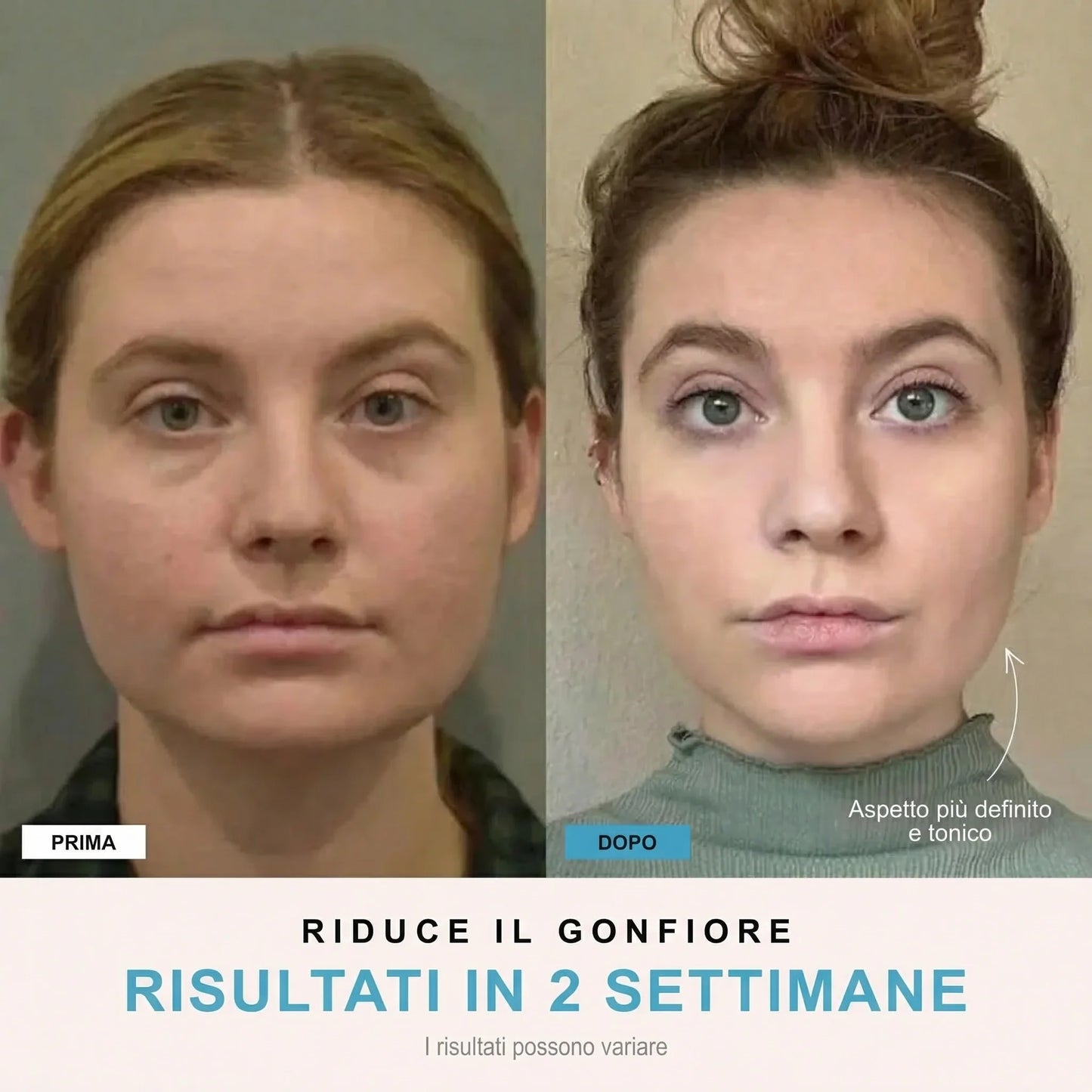 Facelia® | Dispositivo rassodante viso + 1 Siero in OMAGGIO