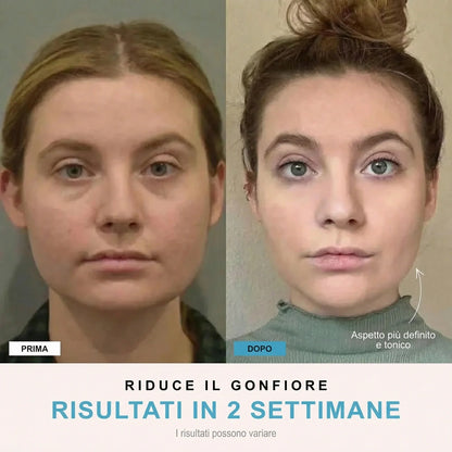 Facelia® | Dispositivo rassodante viso + 1 Siero in OMAGGIO