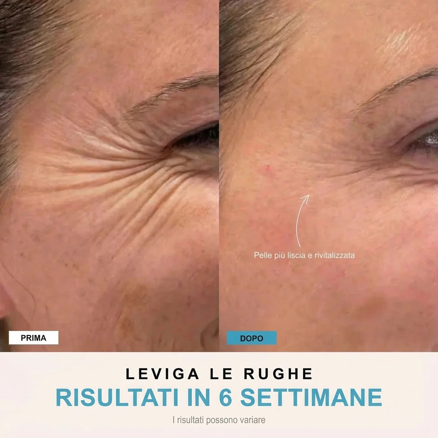 Facelia® | Dispositivo rassodante viso + 1 Siero in OMAGGIO